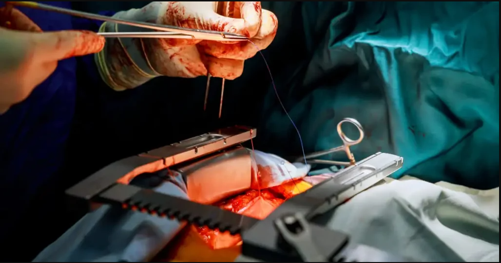 Além do Sorriso: O Papel Vital da Cirurgia Torácica