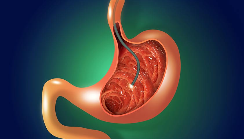 O Olhar que Protege: A Endoscopia Digestiva Pediátrica