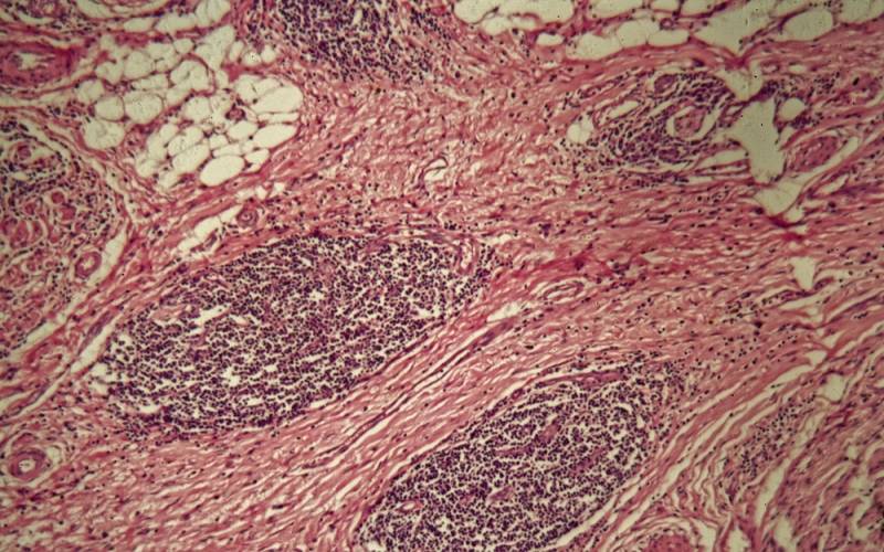 O que são anatomia patológica e a Citopatologia?