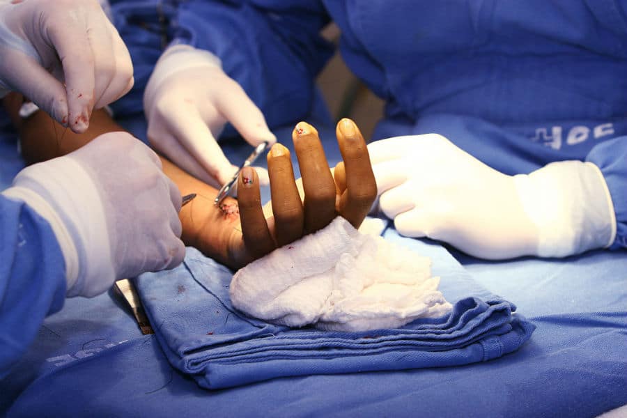 Resgatando Movimentos: A Importância da Cirurgia da Mão