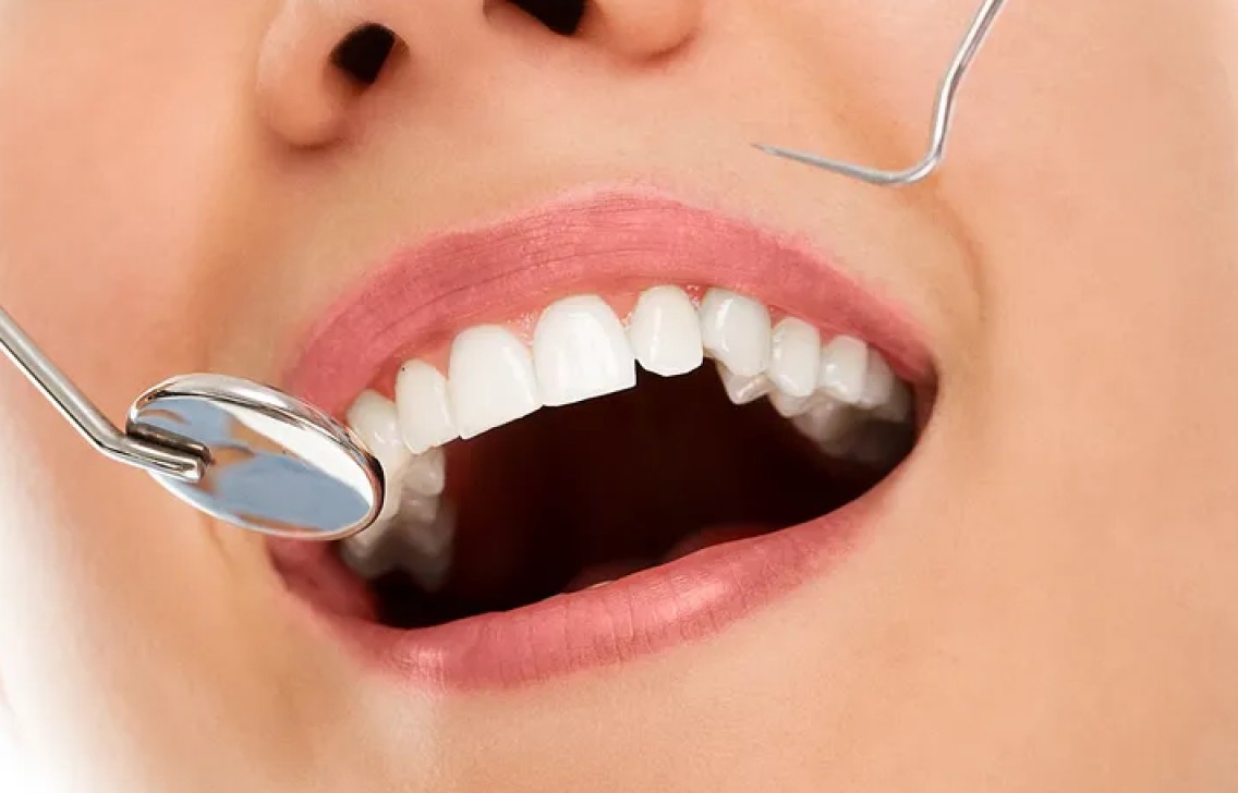 Sorriso Jovem e Saudável: Como os Cuidados com os Dentes Retardam o Envelhecimento