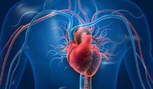 Como Tratar Infarto do Miocárdico de Forma Natural e Segura em Casa