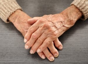 Como Tratar Artritismo de Forma Natural e Segura em Casa