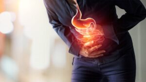 Como Tratar Azia de Forma Natural e Segura em Casa