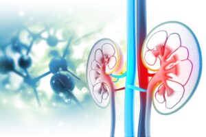 Como Tratar Anúria de Forma Natural e Segura em Casa
