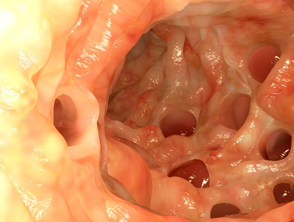 doenca-cardiovascular-1-e1624286475816